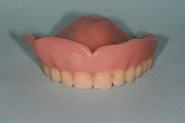Wax Spacer Designs In Complete Dentures Peru NE 68421